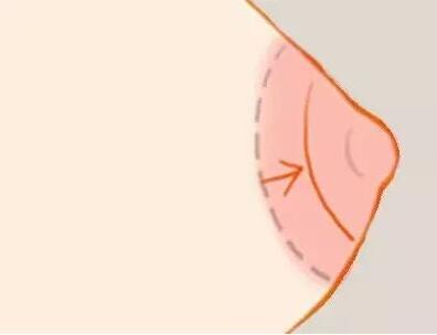 乳晕漂红多久恢复?