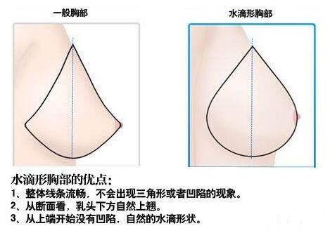 水滴型乳房是什么样?