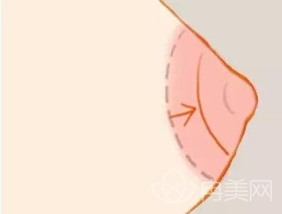 乳晕漂红多久才自然?
