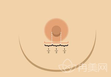 广州乳头缩小大概要多少钱？会影响哺乳和敏感度吗？