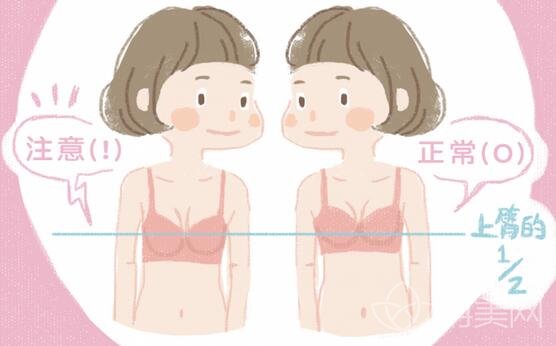 怎样能看出自己是否胸下垂?