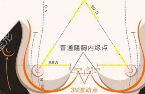 巨乳缩小需要多少钱?胸大困扰的看过来