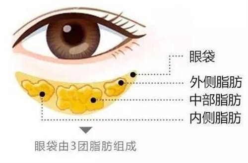 黑眼袋怎么去除？小窍门有哪些？