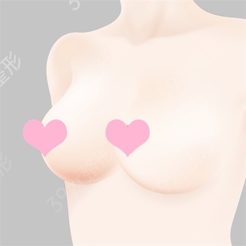 乳晕黑怎么办?乳晕黑是怎么回事?