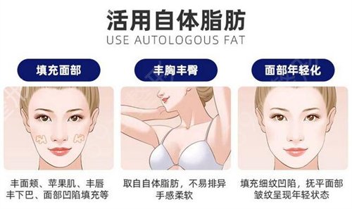 分享北京自体隆胸变美日记，从小女人成为大女人找回女性魅力