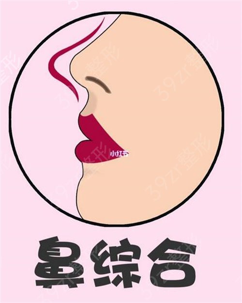 膨体隆鼻手术费用是多少钱?
