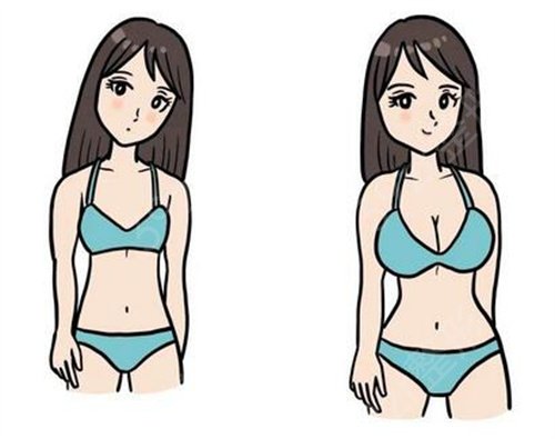 北京做隆胸多少钱?原来这些因素与费用息息相关!速看……