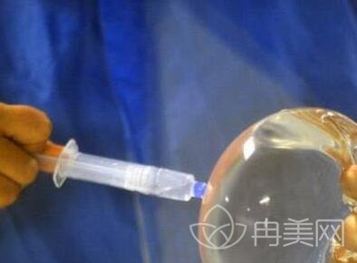*丰胸多少钱?价格贵吗?