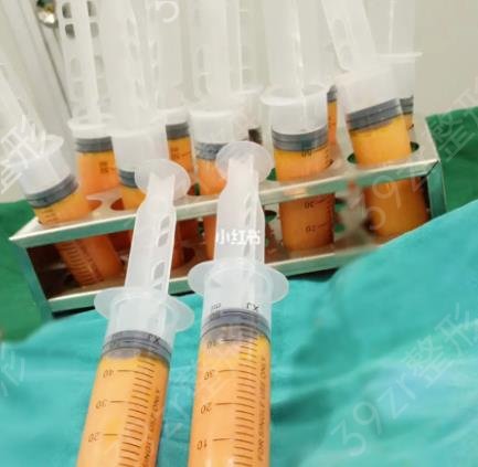 脂肪填充胸部价格，揭秘脂肪填充胸部价格的因素