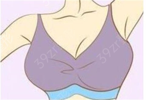 假体隆胸全过程是怎样的？术后恢复、注意事项收藏